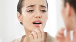 Cold sores symptoms start with a tingling, burning sensation to affected area
